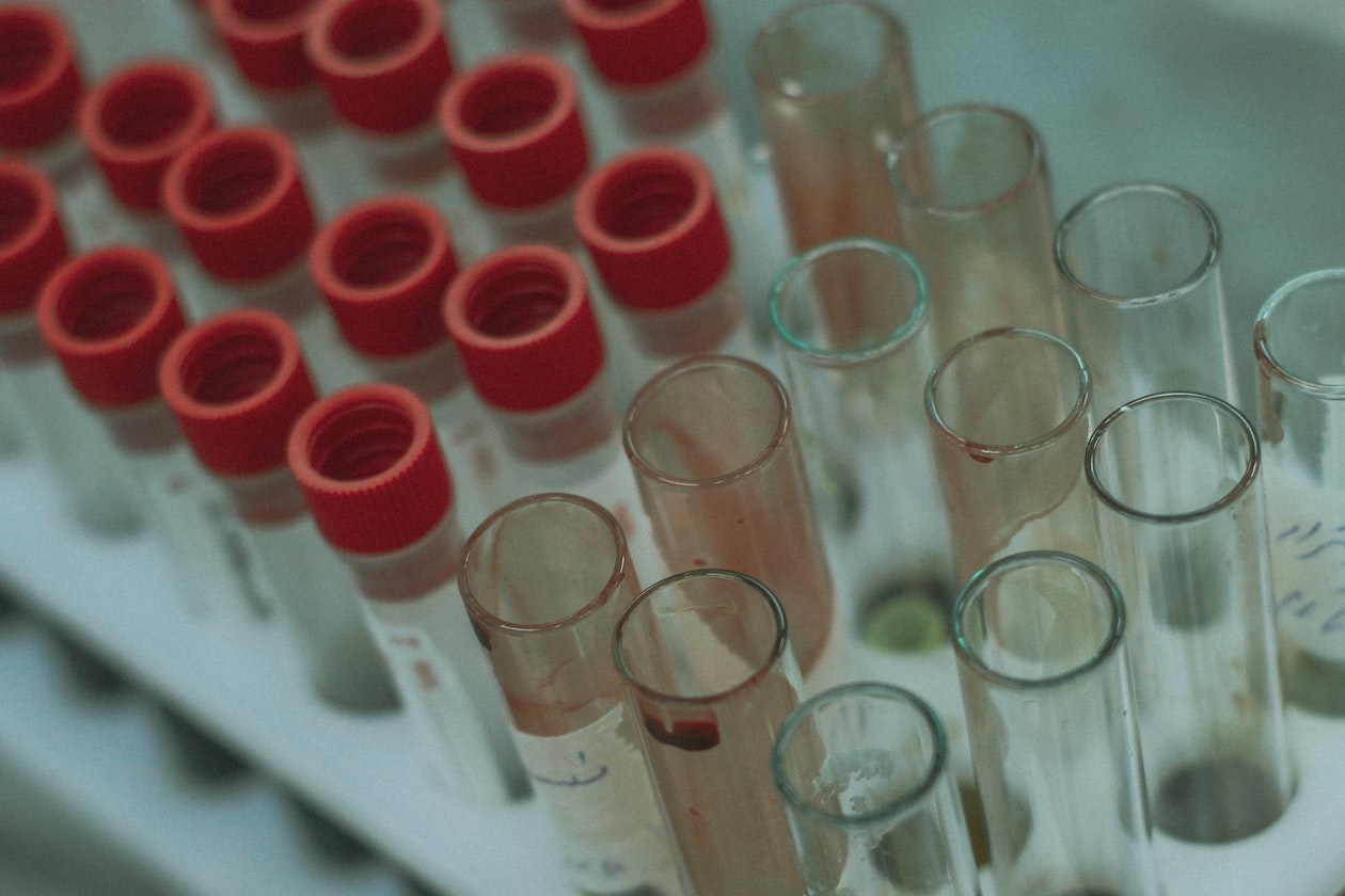 Functional Medicine Testing at Home: The Data-First Guide to Recovery