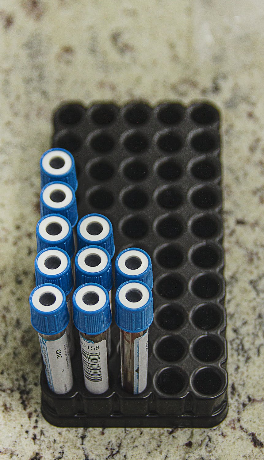OAT Test Explained: What Organic Acids Testing Reveals About Your Health